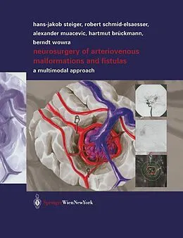E-Book (pdf) Neurosurgery of Arteriovenous Malformations and Fistulas von Robert Schmid-Elsaesser, Alexander Muacevic, Hartmut Brückmann