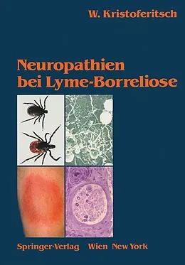E-Book (pdf) Neuropathien bei Lyme-Borreliose von Wolfgang Kristoferitsch