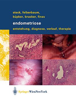 Kartonierter Einband Endometriose von Thomas Steck, Ricardo E. Felberbaum, Wolfgang Küpker