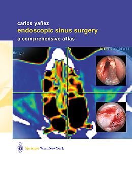 Kartonierter Einband Endoscopic Sinus Surgery von Carlos Yañez