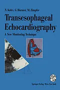 E-Book (pdf) Transesophageal Echocardiography von Nikolai Kolev, Günter Huemer, Michael Zimpfer