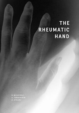 eBook (epub) The Rheumatic Hand de Raphael Micheroli, Giorgio Tamborrini, Diego Kyburz