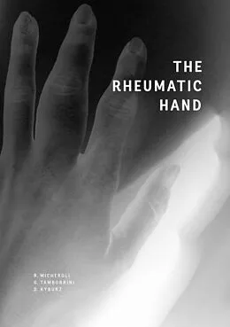 E-Book (epub) The Rheumatic Hand von Raphael Micheroli, Giorgio Tamborrini, Diego Kyburz