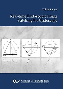 E-Book (pdf) Real-time Endoscopic Image Stitching for Cystoscopy von Tobias Bergen