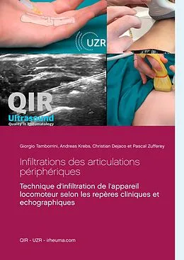 E-Book (epub) Infiltrations des articulations périphériques von Giorgio Tamborrini, Andreas Krebs, Christian Dejaco