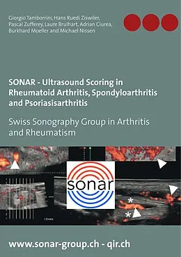 E-Book (epub) SONAR - Ultrasound Scoring in Rheumatoid Arthritis, Spondyloarthritis and Psoriasisarthritis von Giorgio Tamborrini, Hans Ruedi Ziswiler, Pascal Zufferey