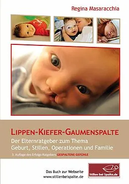 E-Book (epub) Lippen-Kiefer-Gaumenspalte von Regina Masaracchia