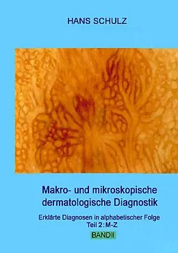 E-Book (epub) Makro- und mikroskopische dermatologische Diagnostik Band 2 von Hans Schulz