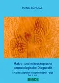 E-Book (epub) Makro- und mikroskopische dermatologische Diagnostik von Hans Schulz