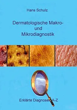 E-Book (epub) Dermatologische Makro- und Mikrodiagnostik von Hans Schulz