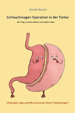 E-Book (epub) Schlauchmagen Operation in der Türkei von Daniela Becker
