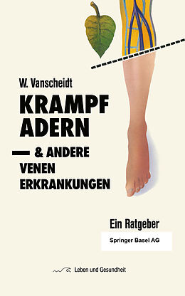 Kartonierter Einband Krampfadern und andere Venenerkrankungen von W. Vanscheidt