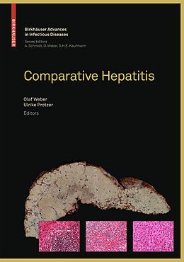 Livre Relié Comparative Hepatitis de 