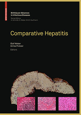 eBook (pdf) Comparative Hepatitis de Axel Schmidt, Olaf Weber, Stefan H. E. Kaufmann