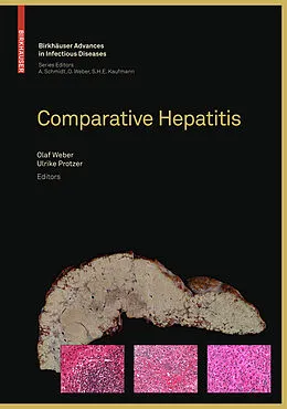 E-Book (pdf) Comparative Hepatitis von Axel Schmidt, Olaf Weber, Stefan H. E. Kaufmann