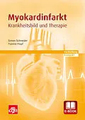 E-Book (pdf) Myokardinfarkt von Simon Schneider, Yvonne Hopf