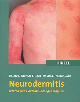 Kartonierter Einband Neurodermitis von Thomas C. Roos, Harald Brost