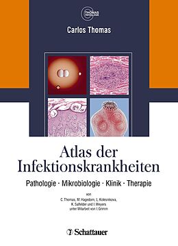 Kartonierter Einband Atlas der Infektionskrankheiten von Carlos Thomas, Annette Cecetka-Thomas, Renate Woicichowski