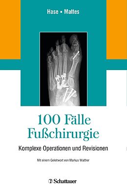 E-Book (pdf) 100 Fälle Fußchirurgie von 