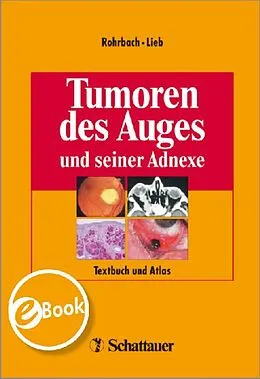 E-Book (pdf) Tumoren des Auges und seiner Adnexe von Jens Martin Rohrbach, Wolfgang E Lieb, Karina Küper
