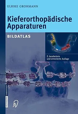 E-Book (pdf) Kieferorthopädische Apparaturen von Ulrike Grohmann