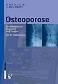 E-Book (pdf) Osteoporose von Klaus M. Peters, Ulrich Deuß