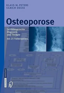 E-Book (pdf) Osteoporose von Klaus M. Peters, Ulrich Deuß