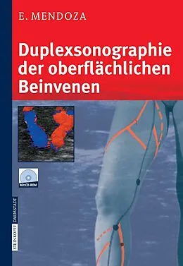 E-Book (pdf) Duplexsonographie der oberflächlichen Beinvenen von Erika Mendoza