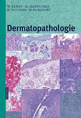 E-Book (pdf) Dermatopathologie von W. Kempf, Markus Hantschke, H. Kutzner