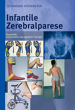 E-Book (pdf) Infantile Zerebralparese von L. Döderlein
