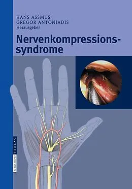 E-Book (pdf) Nervenkompressionssyndrome von Hans Assmus, Gregor Antoniadis