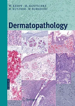 E-Book (pdf) Dermatopathology von Werner Kempf, Markus Hantschke, Heinz Kutzner