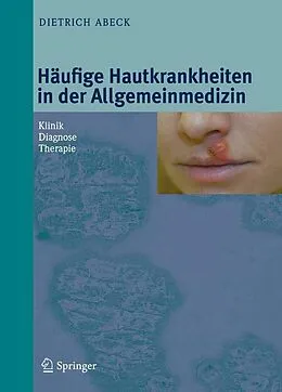 E-Book (pdf) Häufige Hautkrankheiten in der Allgemeinmedizin von Dietrich Abeck