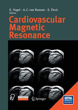 E-Book (pdf) Cardiovascular Magnetic Resonance von 
