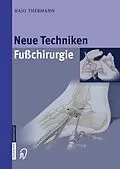 E-Book (pdf) Neue Techniken Fusschirurgie von Hajo Thermann