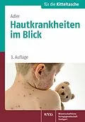 E-Book (pdf) Hautkrankheiten im Blick von Yael Adler