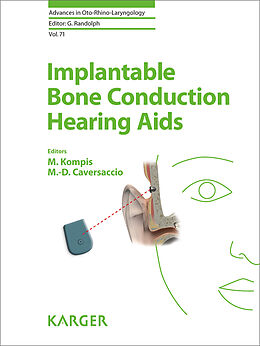 E-Book (pdf) Implantable Bone Conduction Hearing Aids von 