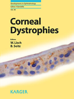 eBook (pdf) Corneal Dystrophies de 