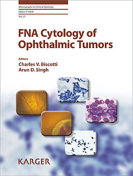 eBook (pdf) FNA Cytology of Ophthalmic Tumors de 