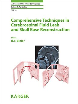 Livre Relié Comprehensive Techniques in CSF Leak Repair and Skull Base Reconstruction de 