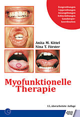 Kartonierter Einband Myofunktionelle Therapie von Anita Kittel, Nina T. Förster