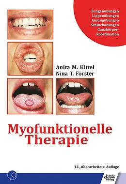 E-Book (pdf) Myofunktionelle Therapie von Anita Kittel, Nina T. Förster