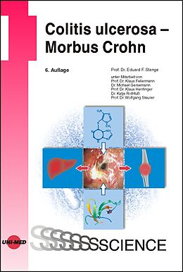Fester Einband Colitis ulcerosa - Morbus Crohn von Eduard F. Stange