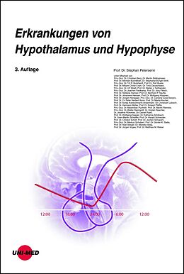 Fester Einband Erkrankungen von Hypothalamus und Hypophyse von Stephan Petersenn