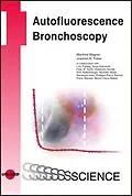 E-Book (pdf) Autofluorescence Bronchoscopy von Manfred Wagner, Joachim H. Ficker