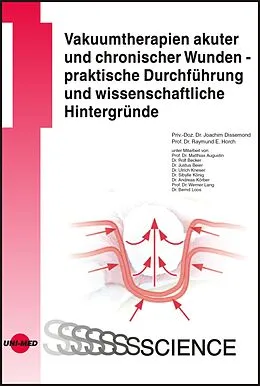 E-Book (pdf) Vakuumtherapien akuter und chronischer Wunden - praktische Durchführung und wissenschaftliche Hintergründe von Joachim Dissemond, Raymund E. Horch