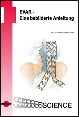 E-Book (pdf) EVAR - Eine bebilderte Anleitung von Gernold Wozniak