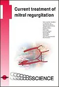 E-Book (pdf) Current treatment of mitral regurgitation von Hans-Joachim Schäfers