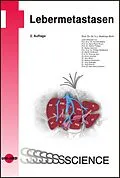 E-Book (pdf) Lebermetastasen von Matthias Birth