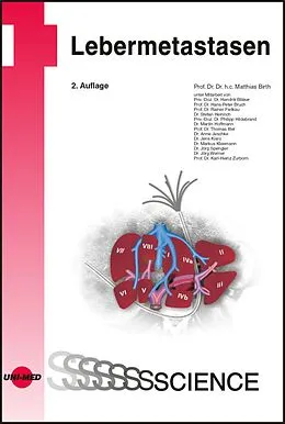 E-Book (pdf) Lebermetastasen von Matthias Birth